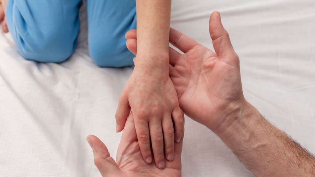 [aggregator] downloaded image for imported item #10519