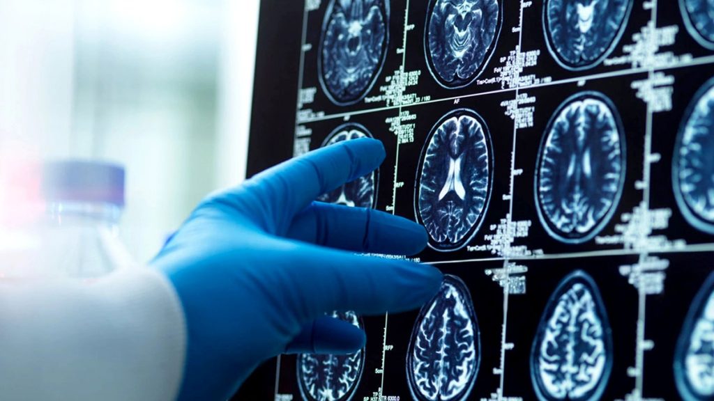 [aggregator] downloaded image for imported item #31424