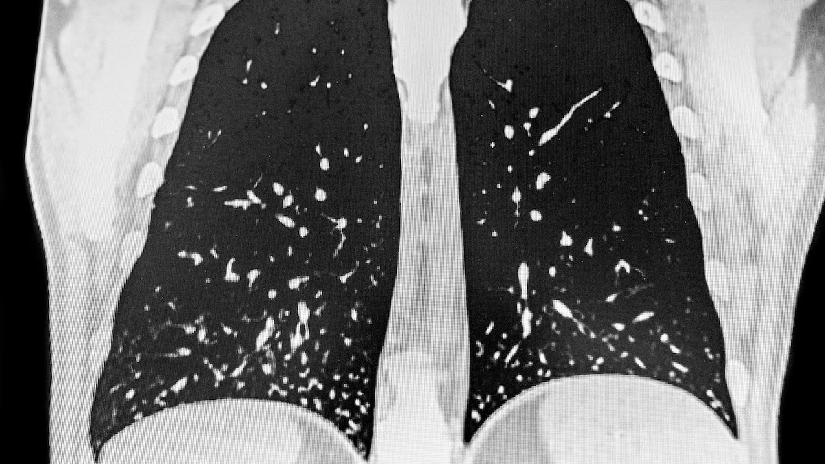 [aggregator] downloaded image for imported item #27194