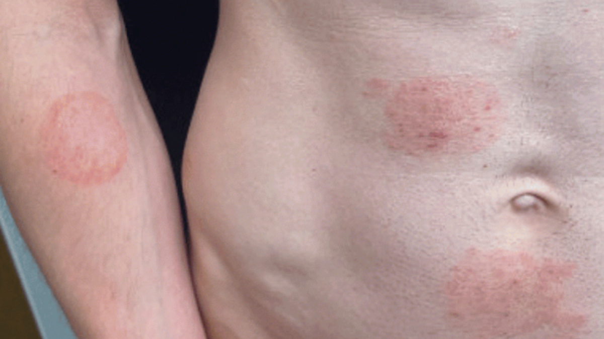 [aggregator] downloaded image for imported item #39810