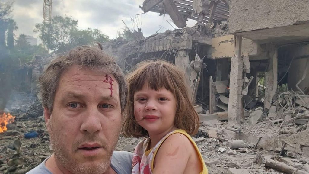 [aggregator] downloaded image for imported item #41444