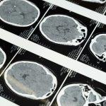 [aggregator] downloaded image for imported item #45860